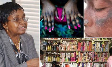 NAFDAC Warn Nigerians Against Usage Of Bleaching Cream, Says Ot Causes Cancer