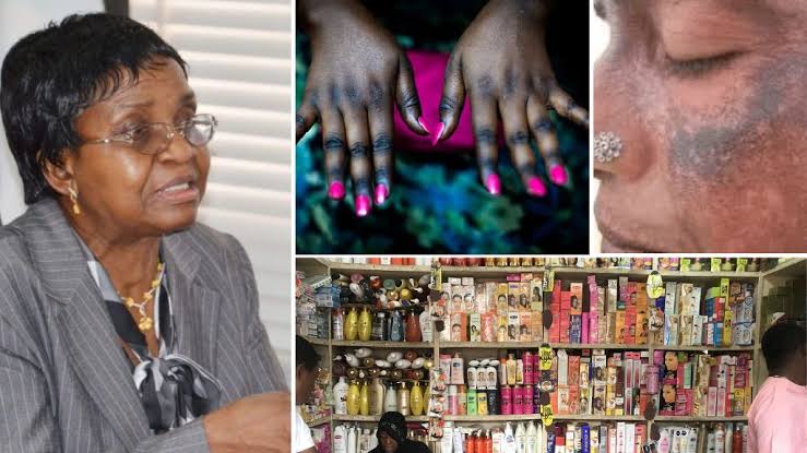NAFDAC Warn Nigerians Against Usage Of Bleaching Cream, Says Ot Causes Cancer
